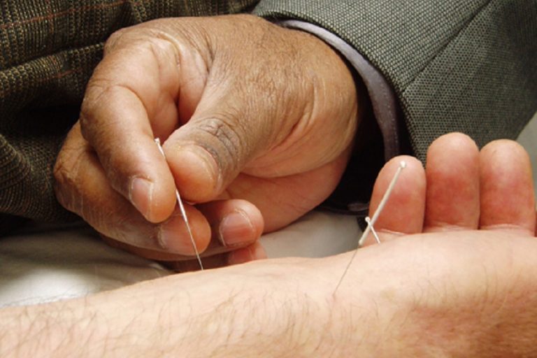 Acupunctura e o relatório da OMS